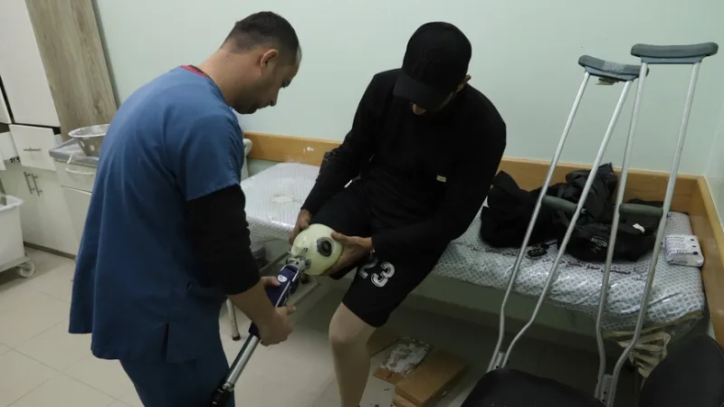 Em Gaza, sob o bloqueio de Israel, os palestinianos esperam meses para receber próteses