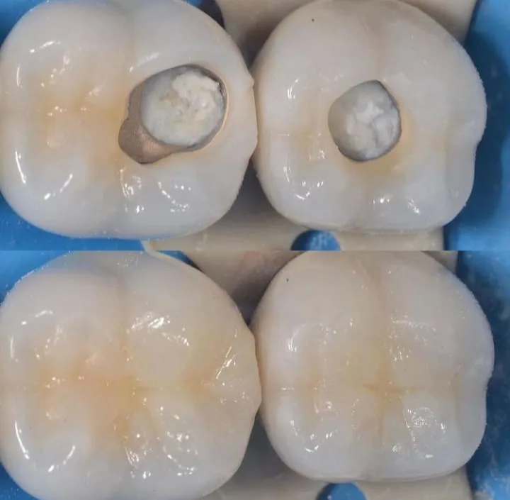 Alanya HEALTHY TEETH Dental Aesthetic — الطب في ألانيا: الطلب عبر الإنترنت والأسعار والتعليقات