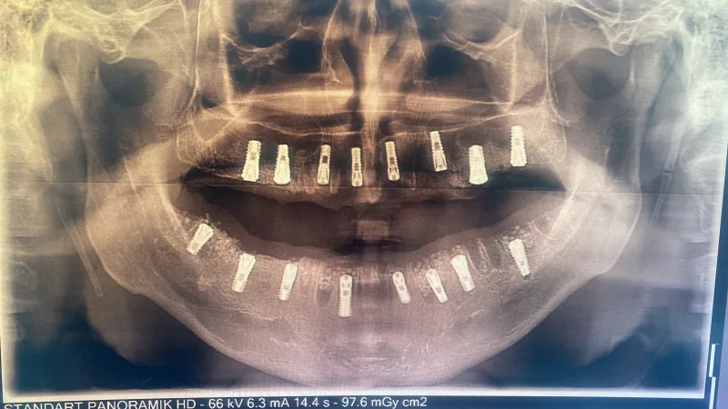 Alanya HEALTHY TEETH Dental Aesthetic — الطب في ألانيا: الطلب عبر الإنترنت والأسعار والتعليقات