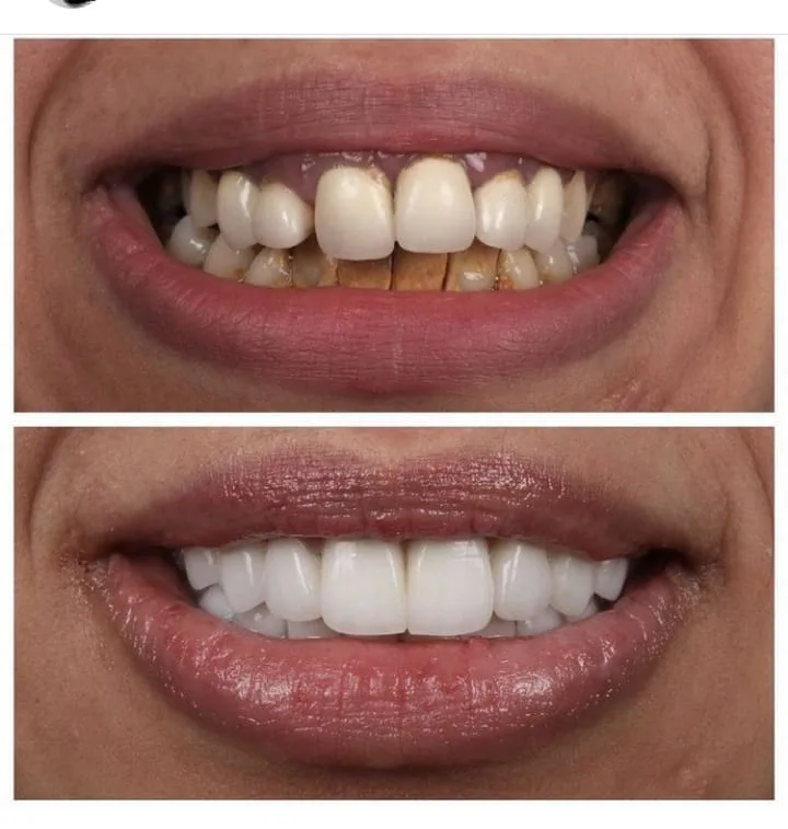 Alanya HEALTHY TEETH Dental Aesthetic — الطب في ألانيا: الطلب عبر الإنترنت والأسعار والتعليقات