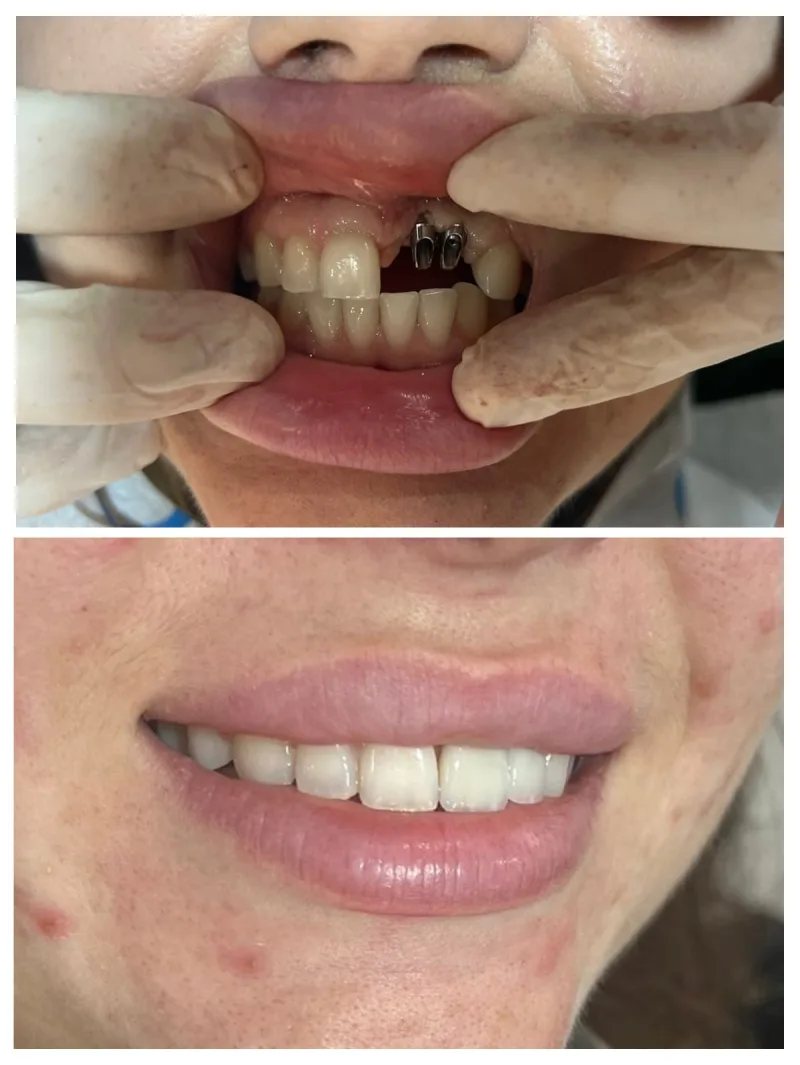Alanya HEALTHY TEETH Dental Aesthetic — الطب في ألانيا: الطلب عبر الإنترنت والأسعار والتعليقات