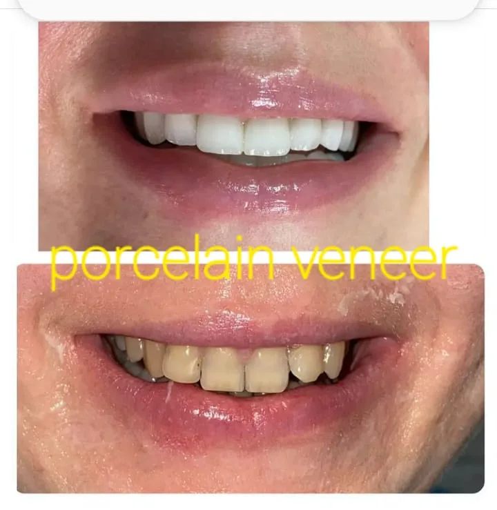 Alanya HEALTHY TEETH Dental Aesthetic — الطب في ألانيا: الطلب عبر الإنترنت والأسعار والتعليقات