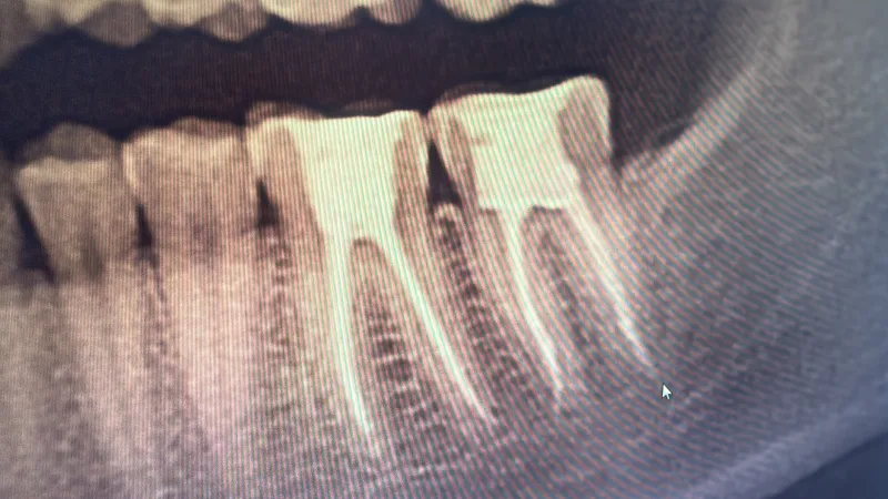 Alanya HEALTHY TEETH Dental Aesthetic — الطب في ألانيا: الطلب عبر الإنترنت والأسعار والتعليقات